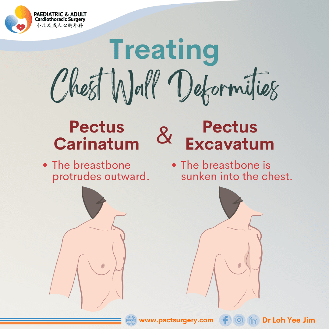 Surgery for Chest Wall Disorders
